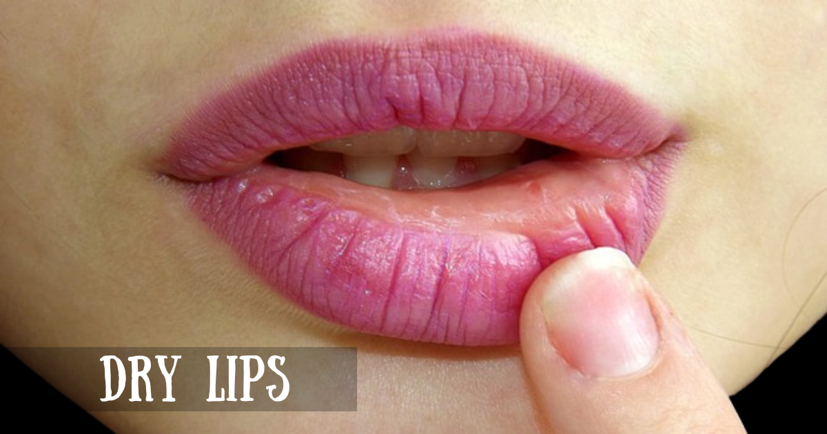 Dry lips and vitamin deficiency: