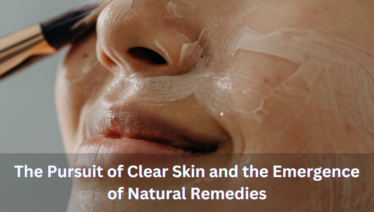 The Pursuit of Clear Skin and the Emergence of 5 Natural Remedies to Treat Acne: